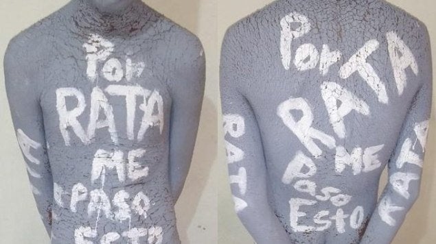 Joven de 15 años es torturado por robar, le amputan las dos manos y las arrojan a su secundaria en Veracruz