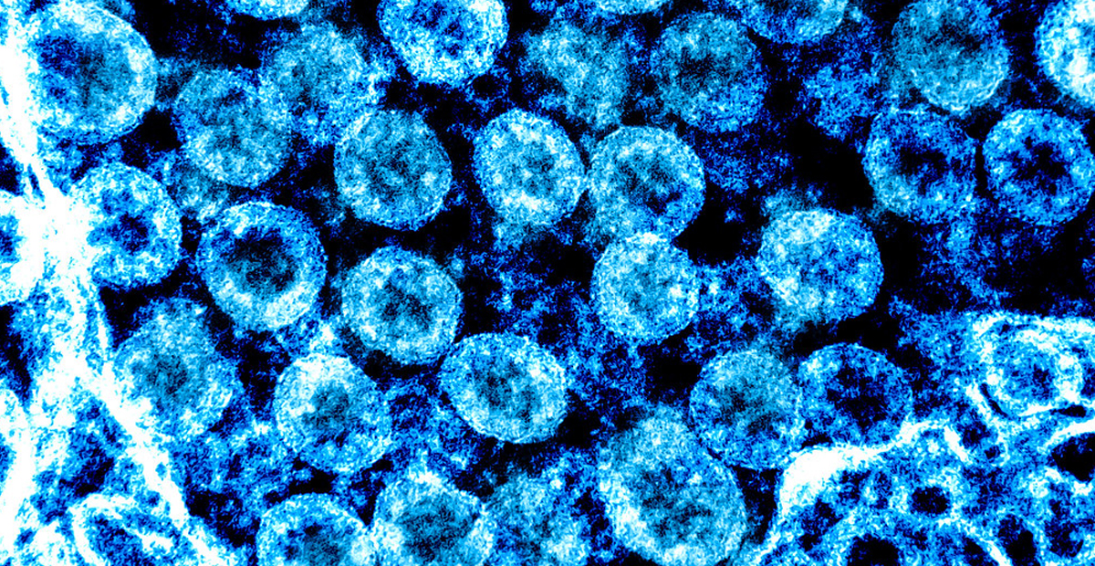 Emiten recomendaciones por alerta de COVID-19 en GR