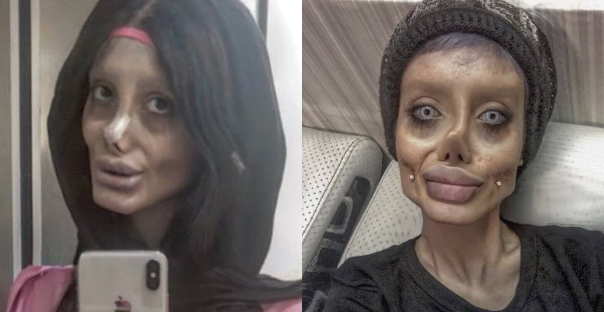 ‘Angelina Jolie’ iraní se debate entre la vida y la muerte por COVID19