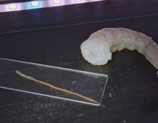 Video: Muestra en microscopio cómo es la ‘vena’ de un camarón y revela qué es