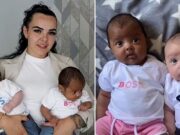 Mujer da a luz a gemelos con distinto tono de piel, ¿cómo sucedió?