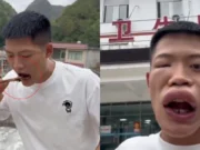 VIDEO: Influencer se come una avispa viva para ganar ‘likes’ y así terminó su rostro