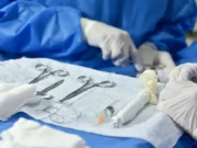Hombre Entra a Cirugía de Vesícula y le Hacen la Vasectomía